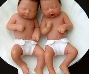 试管婴儿囊胚移植过程怎么样？要检查什么？