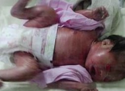 佛山三代试管医院哪家收费合理？性价比大揭秘